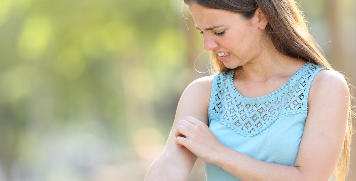 A woman itching her bug bite.